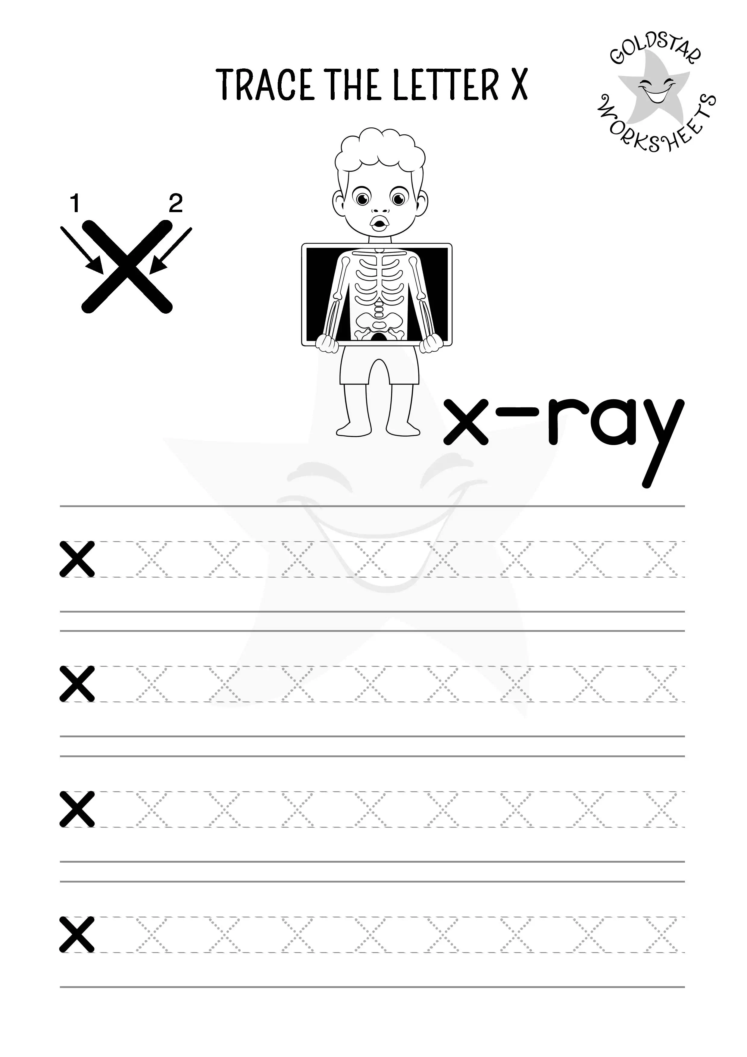Letter x lowercase tracing and coloring worksheet. See the results for an x-ray